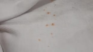 tablecloth-stain